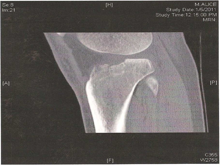 38234.jpeg 38234.jpeg