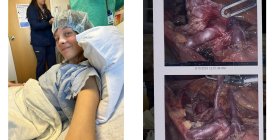 The Bella Bacon Interview: Understanding Her Health Conditions, Building Mental Strength & Her Comeback