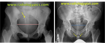 692169.png 692169.png