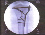 998144.jpeg 998144.jpeg