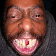 CrackHead.