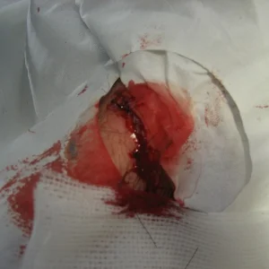 Stitches!!!