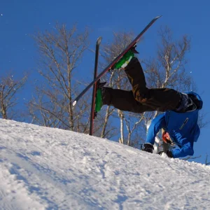 = messed up collar bone