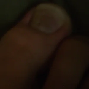 Drilled out toe bang