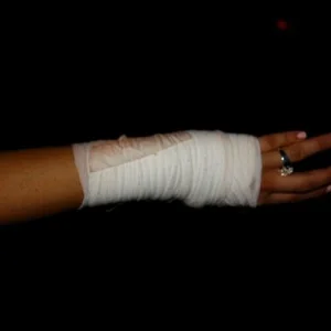 Stupid snowboarding injury