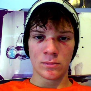 Broken face