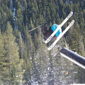 Toren ACL MCL LCL miniscus