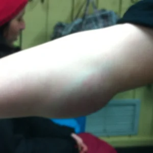 landed on my arm a couple time