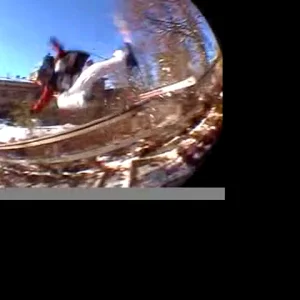 Torn acl and broken back in two places