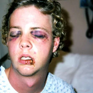 HE LOOKS LIEK ORFEO!