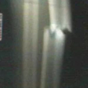 x-ray