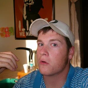 Been a while since i uploaded a pic. So, heres the burns, baby.