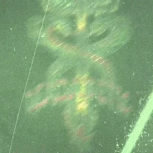 Deadabetic 'Skiing so hard I cry' | S1 EP02