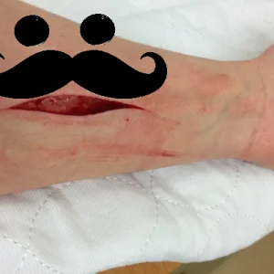 Lesley's Gash