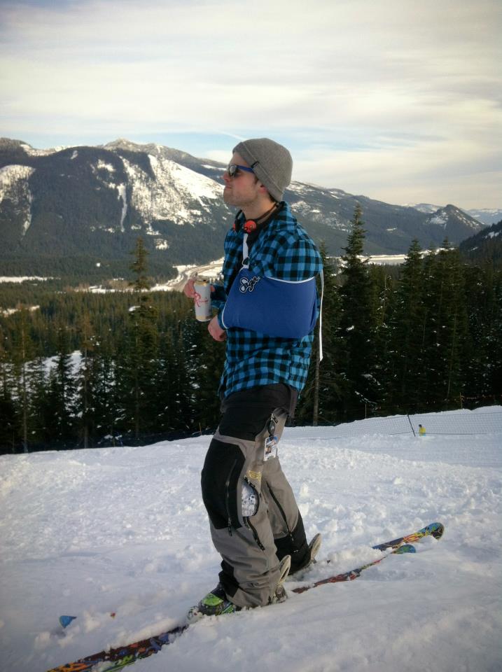 2 weeks post torn labrum