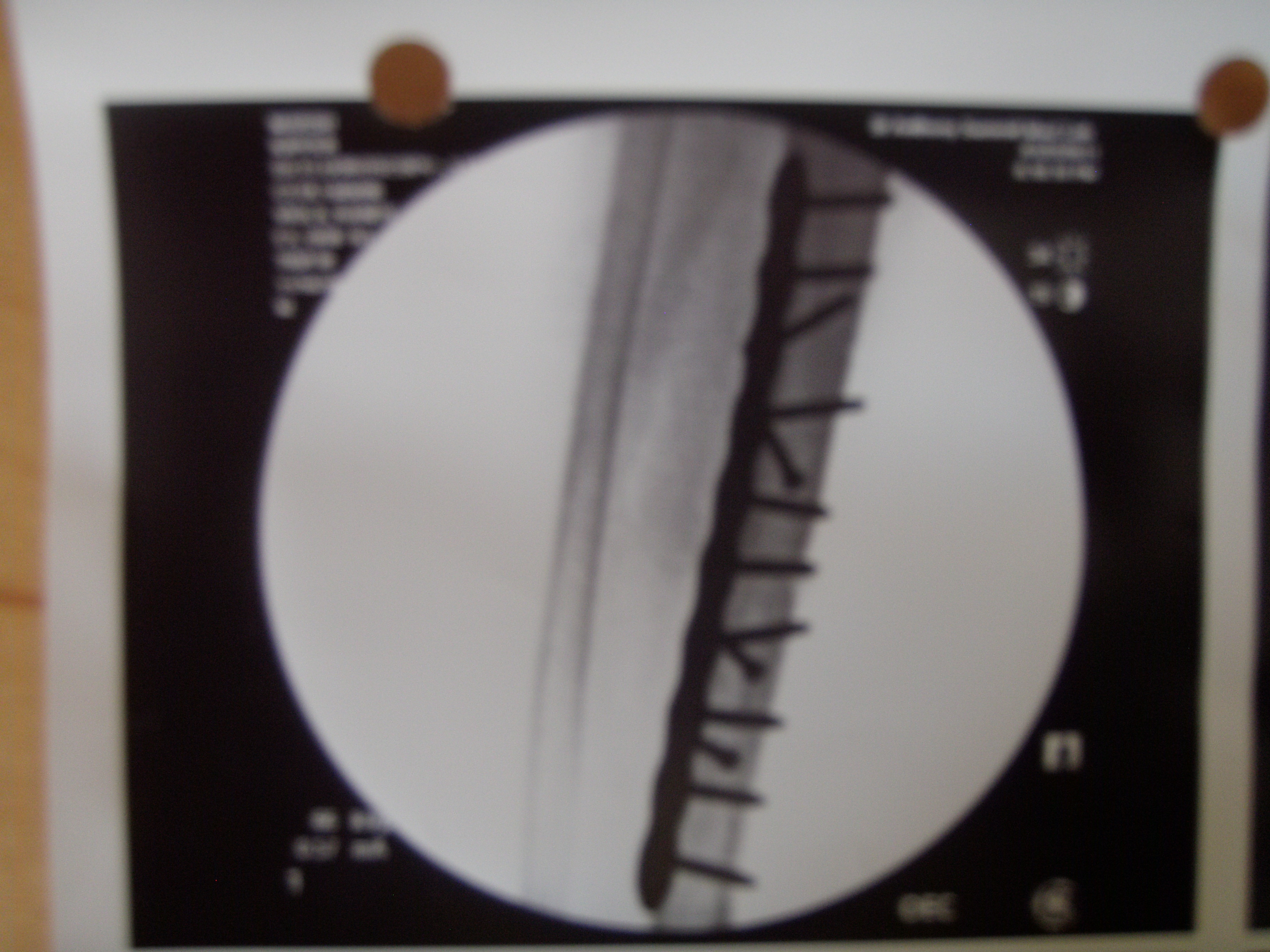 2011 injury hardware 