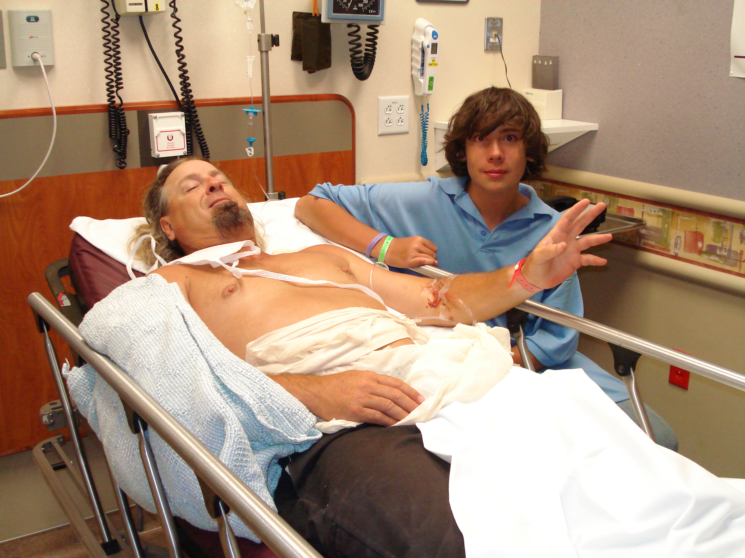 3 broken bones
