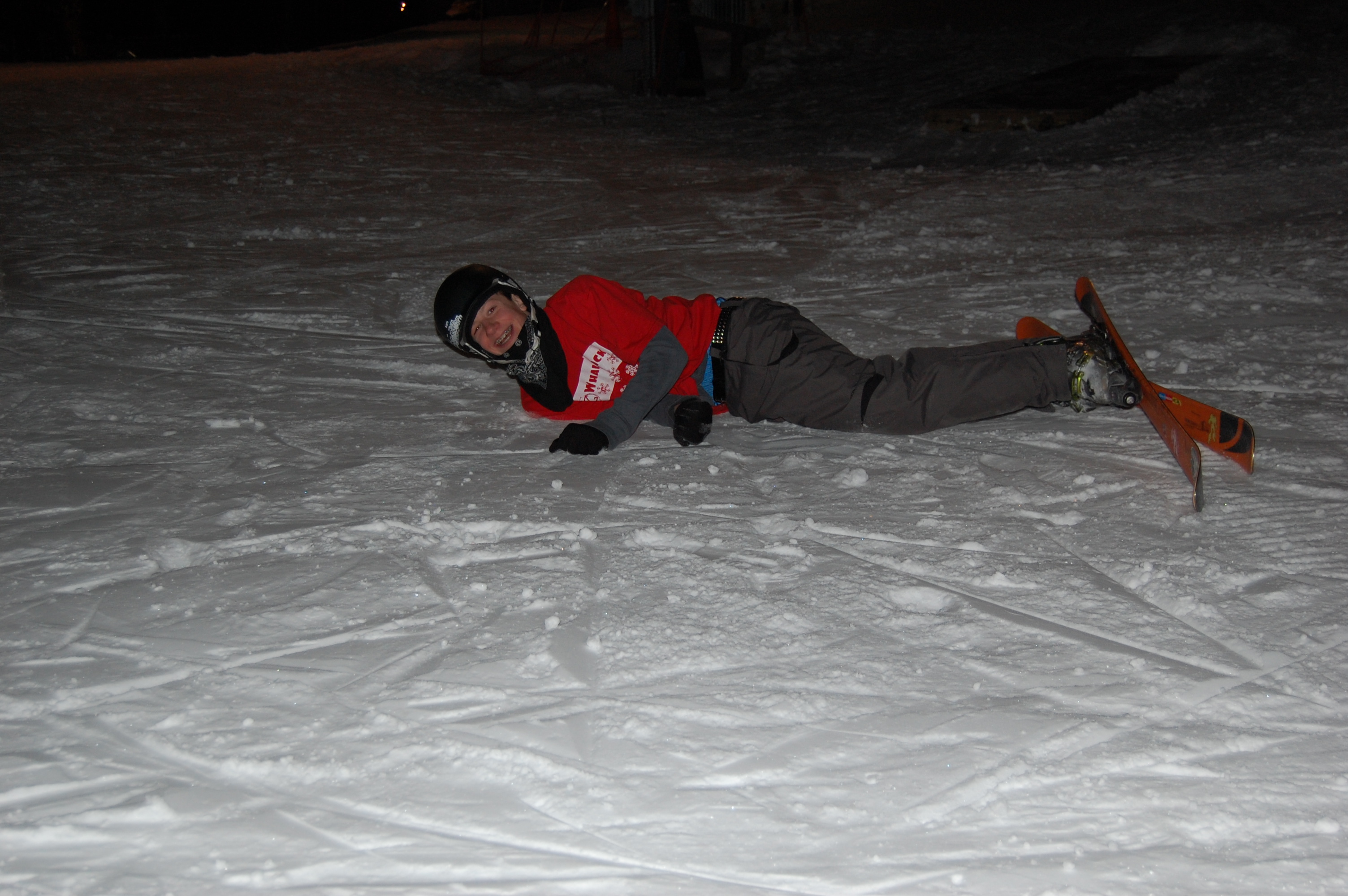 5 years ago!!!! and that hurt, i wasnt laughing.