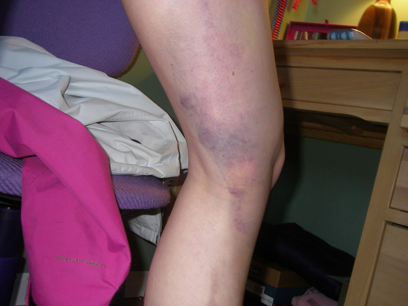 A normal day of my life