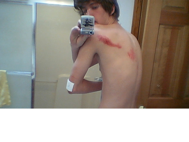 after falling out of a truck at 30