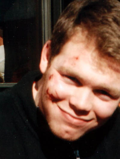 After the tree beat me up.