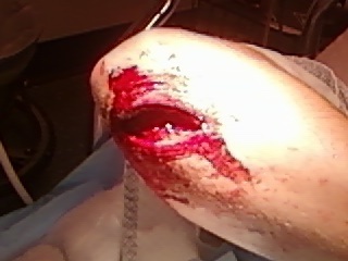 After they cleaned up the blood