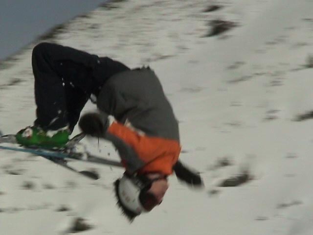 Backflip with left arm in plaster