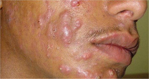 Before_For thread. NOT ME hah