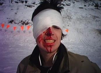 Bloody mess coming out of pipe