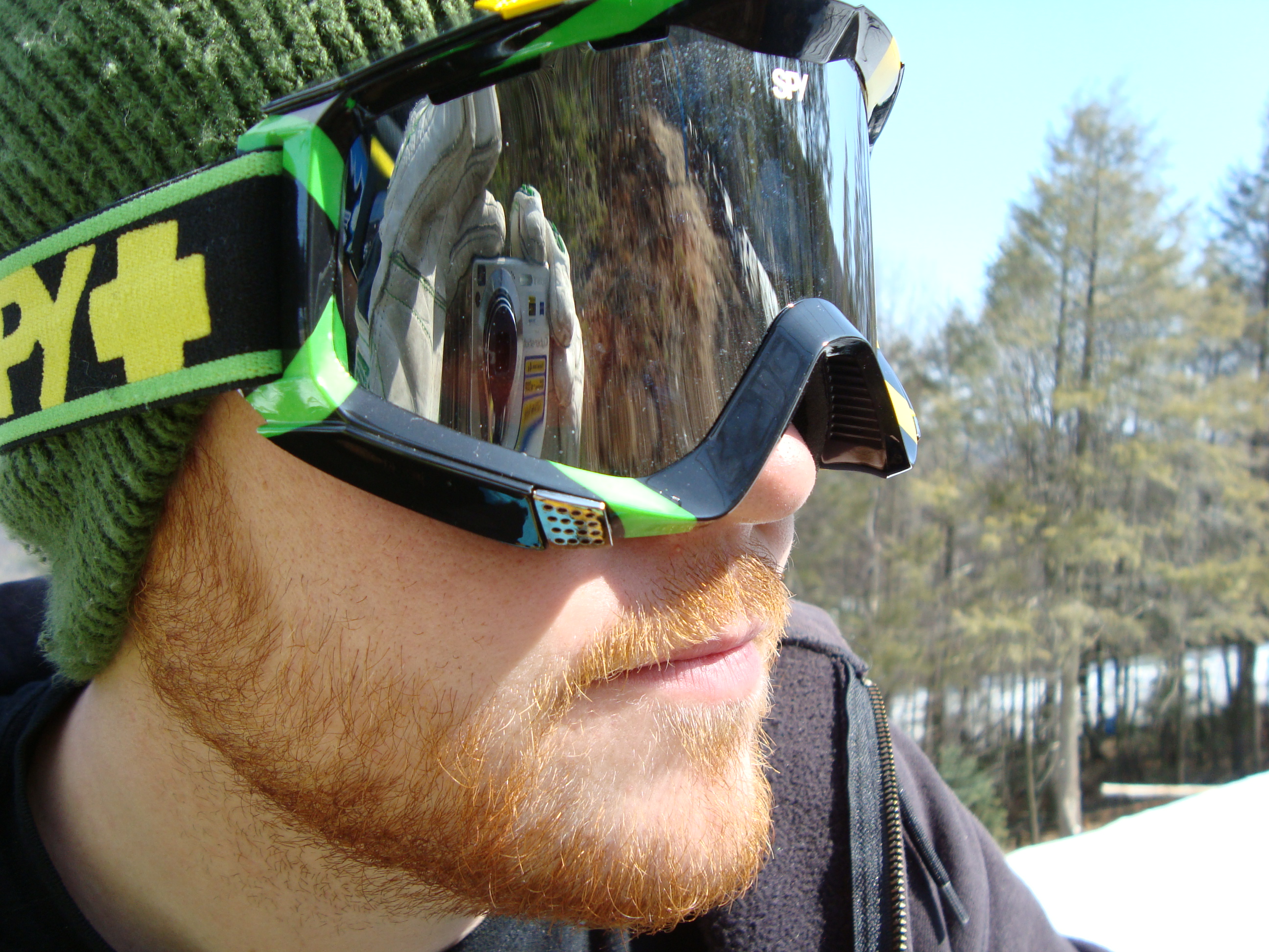 Blown up knee Journalism project=excuse to ride.