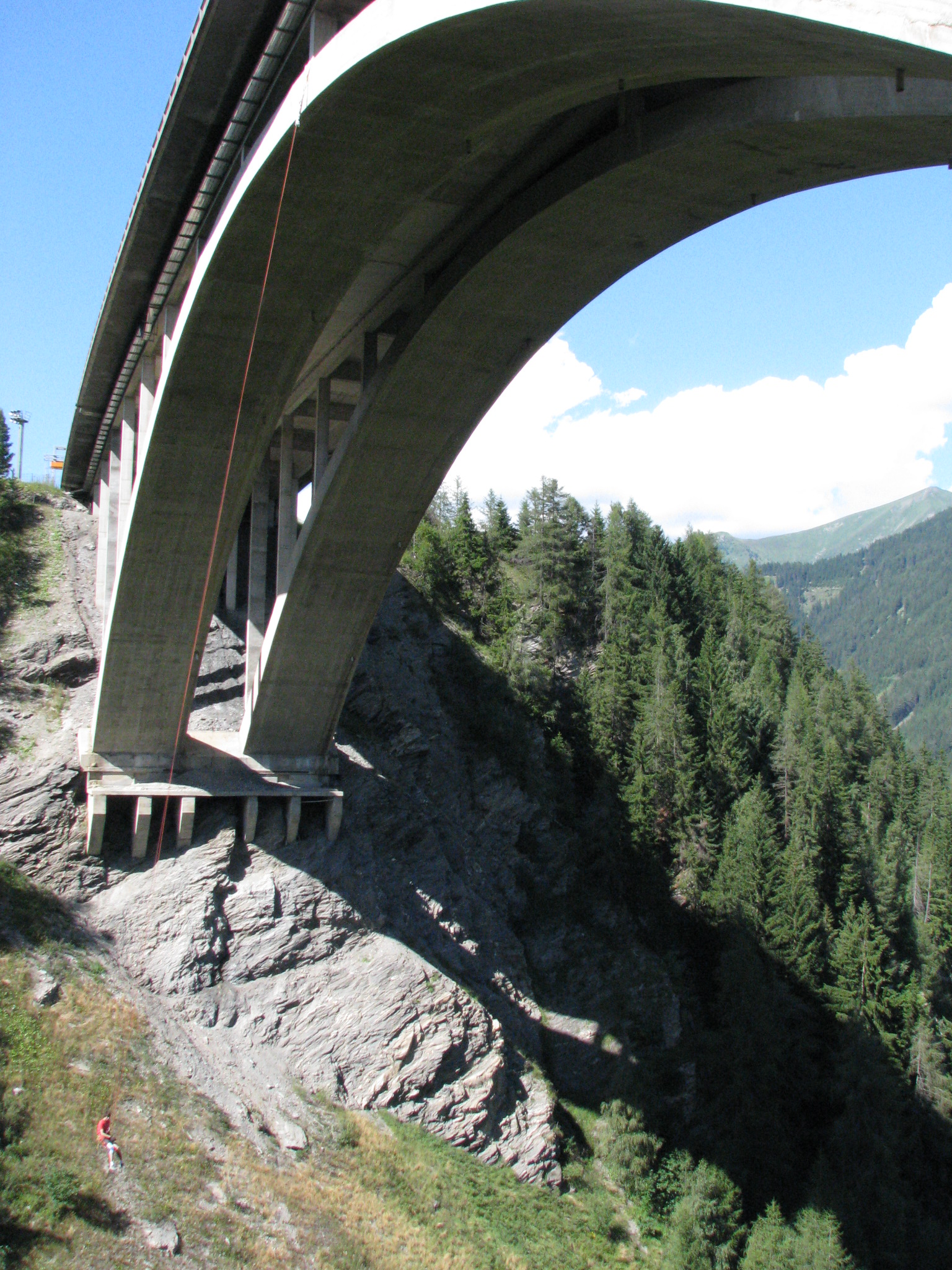 Bored and injured in summer4