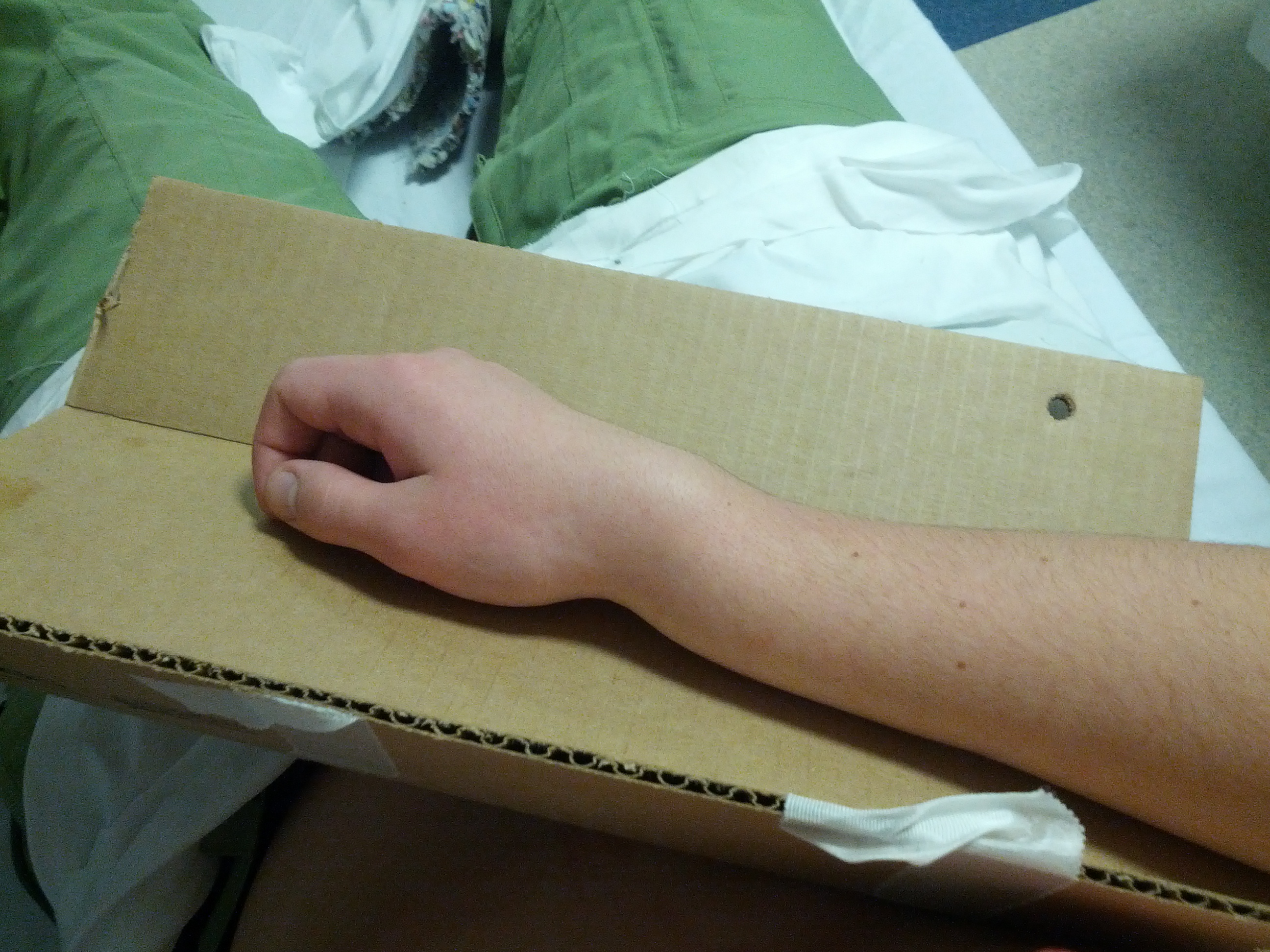 Broke my wrist