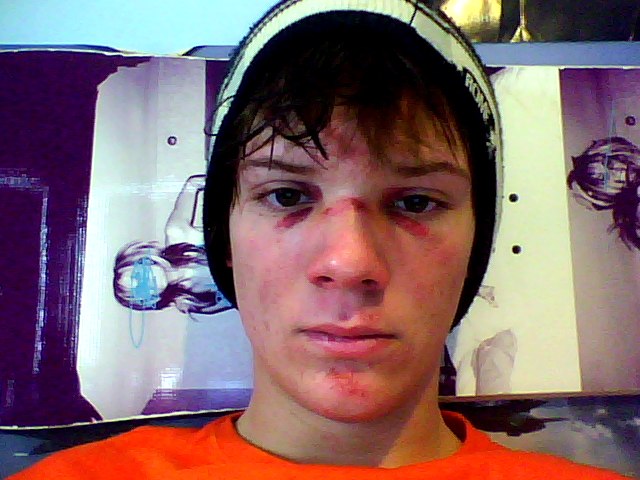 Broken face