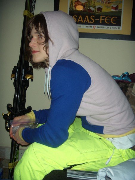 Broken thumb and concussion