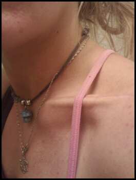 Clavicle...super attractive