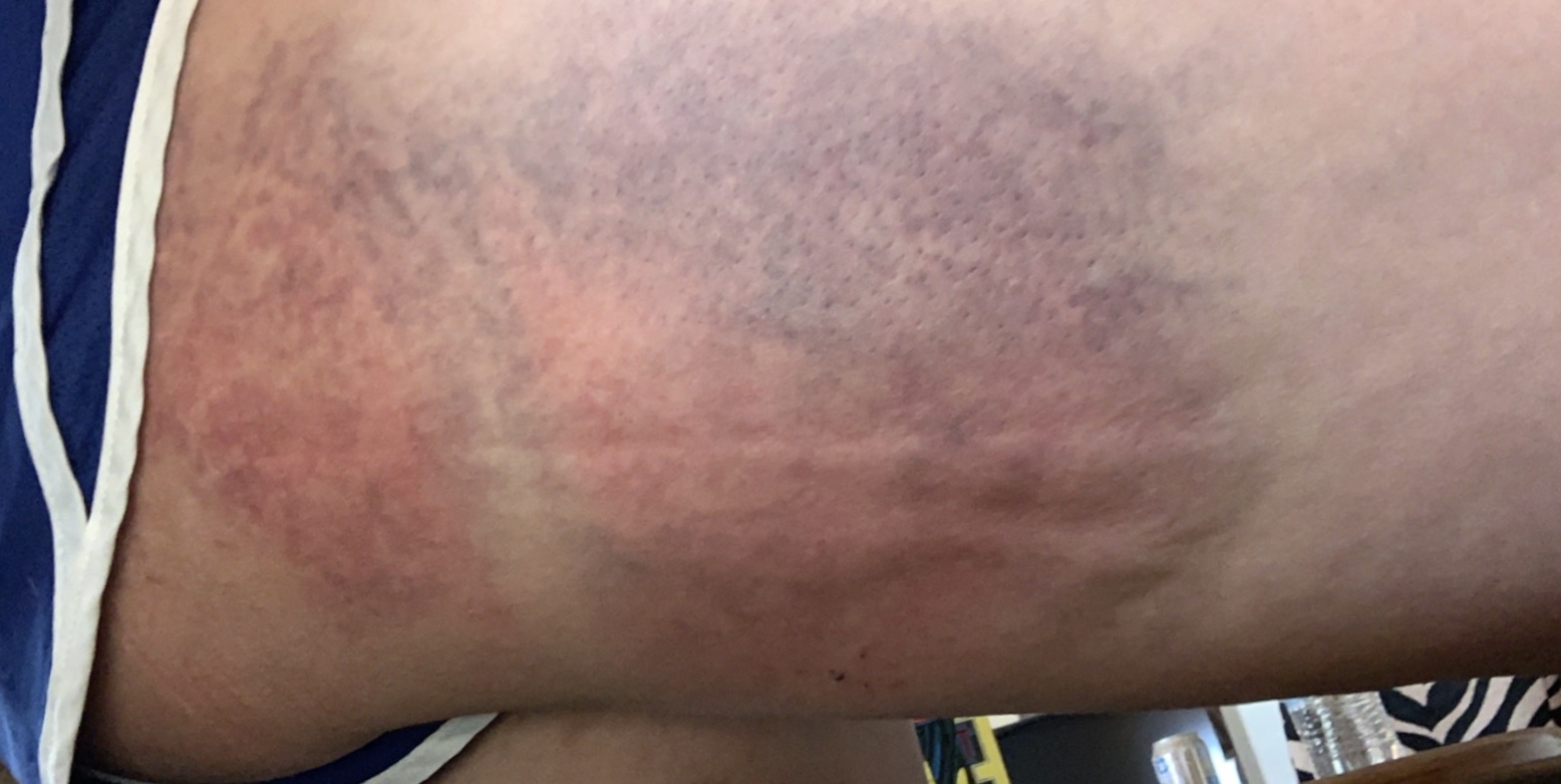 Cliff diving gone wrong