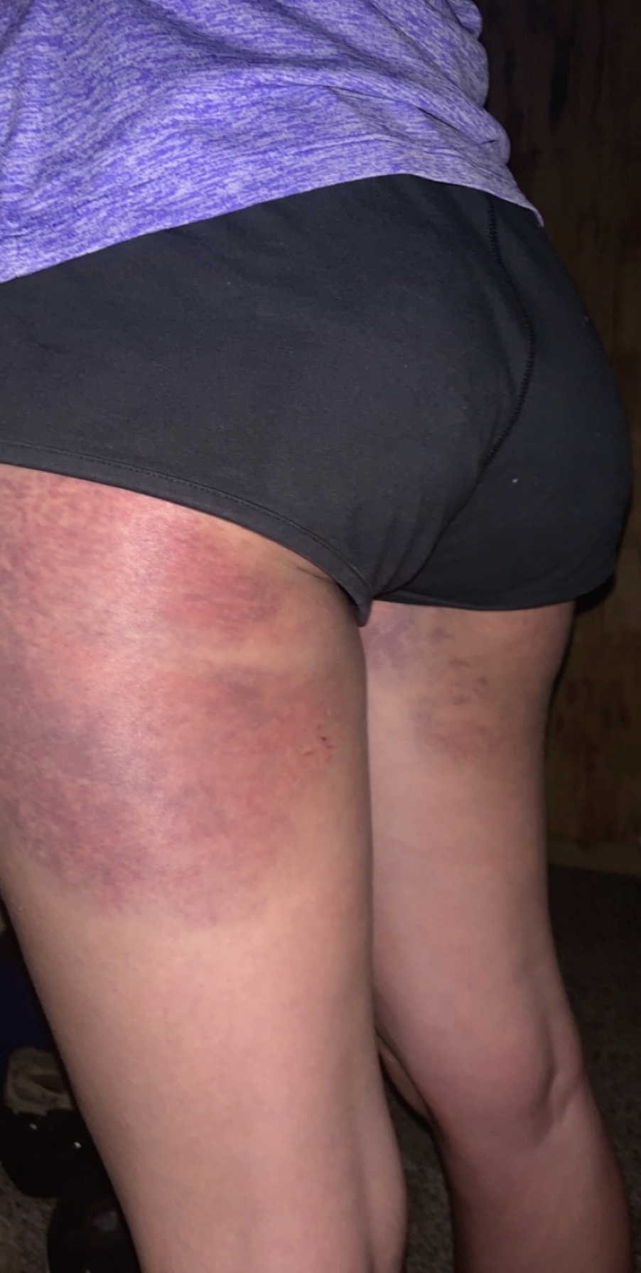 Cliff diving gone wrong