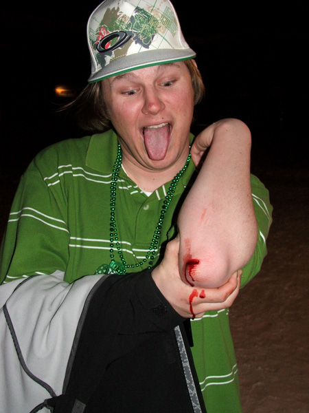 Cody Carter dont need no stitches