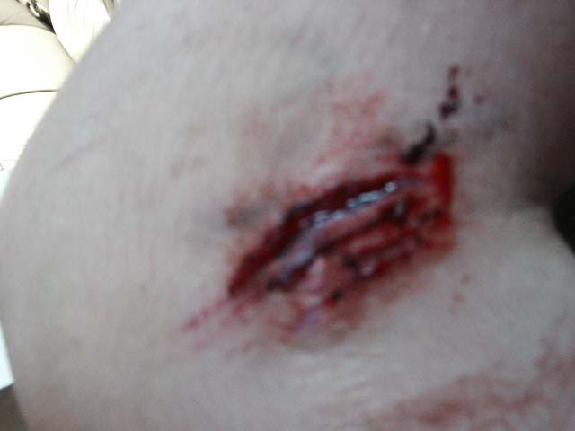 cousin crashed riding skinnies numero dos