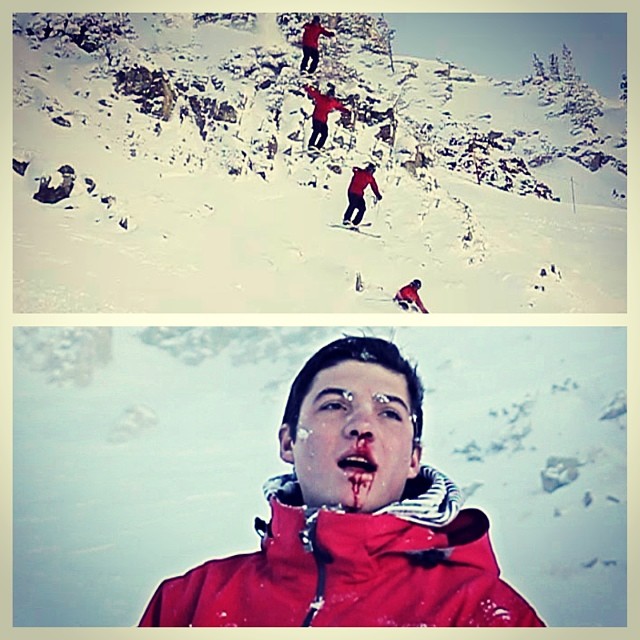 Dan breaking his face