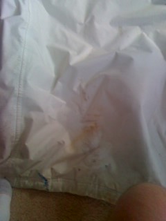 Dirt on Oakley Coat- butt area