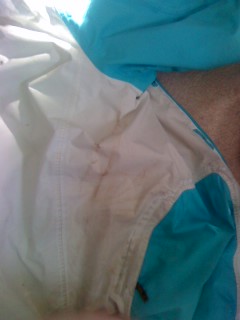 Dirt under right arm