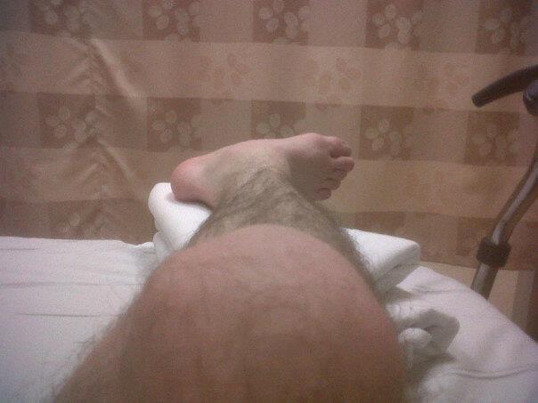 dislocated + 4 break 2