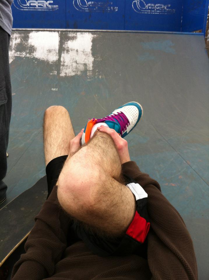 Dislocated + 4 break