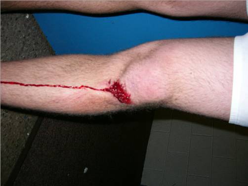 don't run naked on ice (Brule' run)