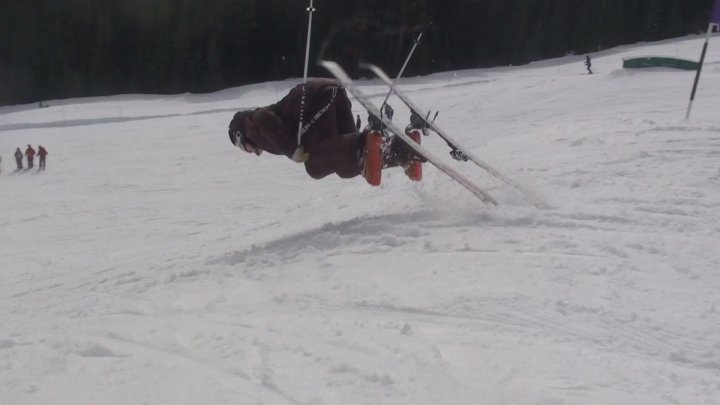 Dub Back Underrotation.