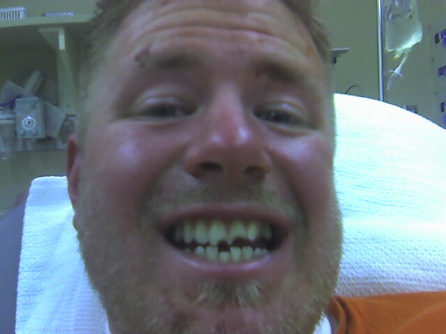 Elbow wasn't the only thing, check the teeth