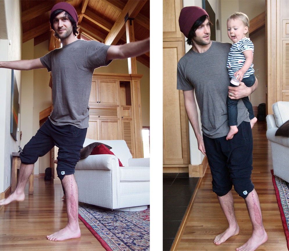 Eric Pollard on the Mend