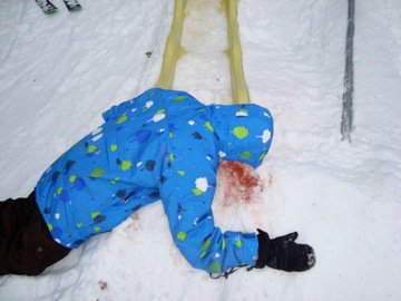 FACE SMASH TRYING TO SLIDE THE SLIDE