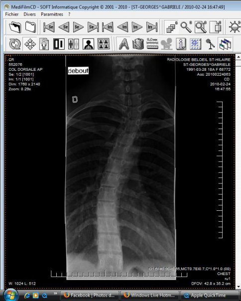 Febuary 24th xray